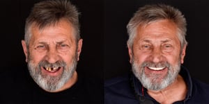 branko_prije_poslije